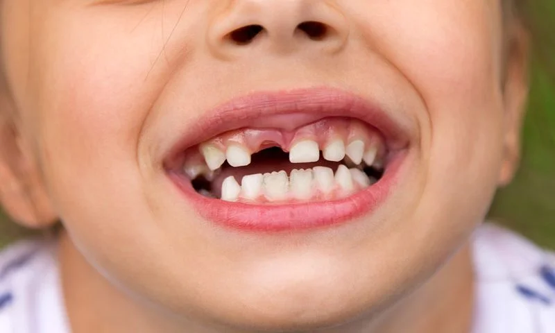 口腔健康从娃娃抓起